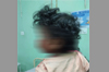 Kasaragod: One-year-old boy seriously injured in stray dog attack